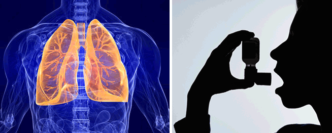 நானும் என் ஆஸ்மாவும்