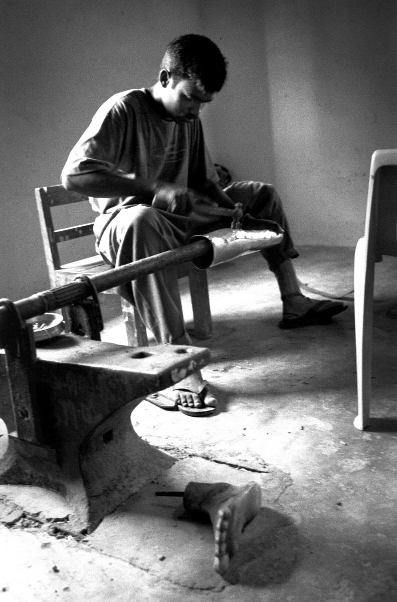 A technician from White Pigeon, a local NGO, fashions an artificial leg out of aluminiu.jpg